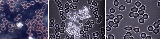 Improve your health through live blood cell analysis
